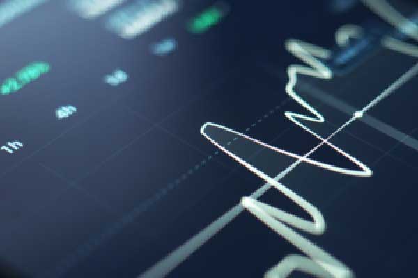 万腾Vatee 2025.11.20黄金市场分析报告